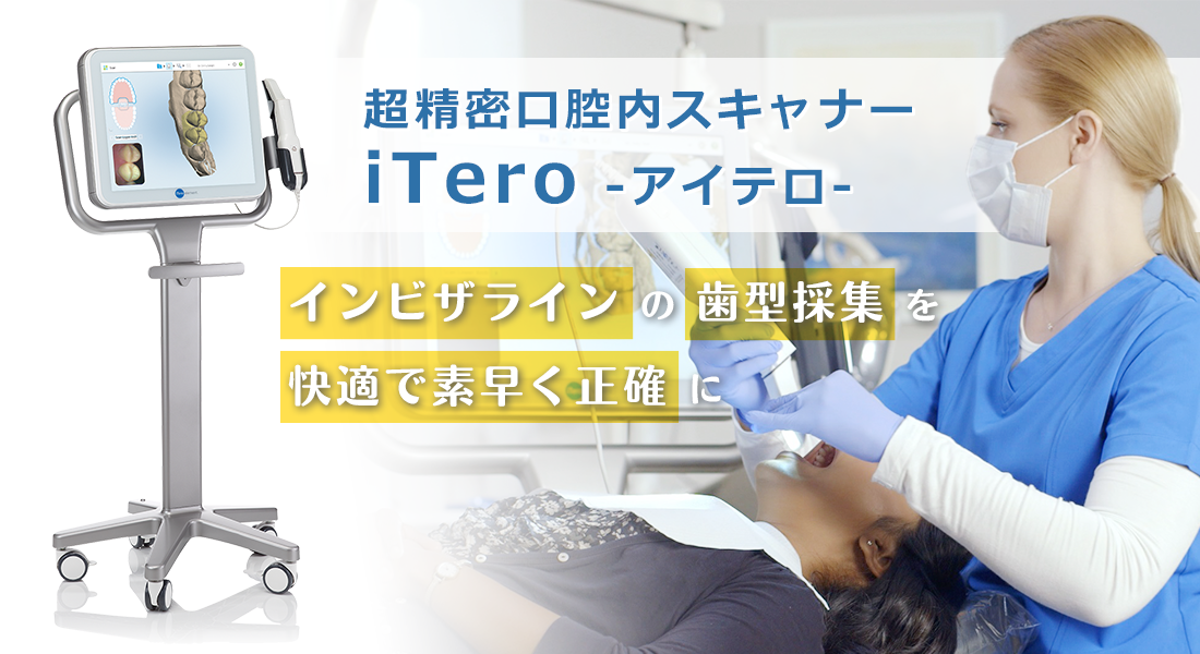 インビザライン対応のスキャナー「iTero（アイテロ）」